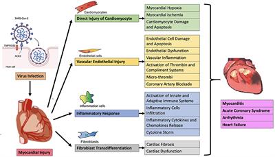 Clinical Characterization and Possible Pathological Mechanism of Acute Myocardial Injury in COVID-19